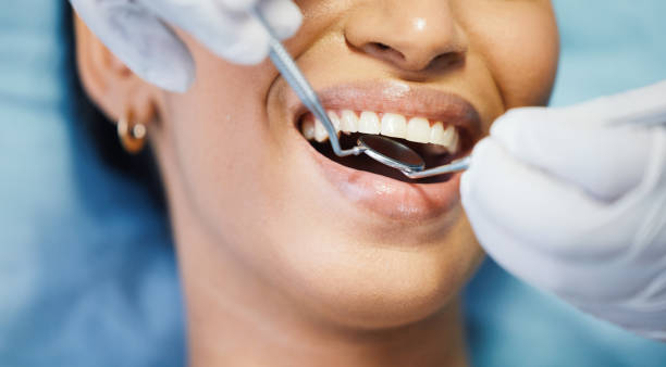 Best Affordable Emergency Dental Care  in Bowie, TX